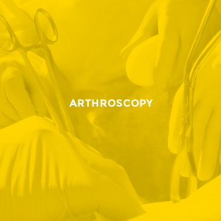 Arthroscopie